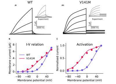 Human Atrial Arrhythmogenesis and Sinus Bradycardia in KCNQ1-Linked Short QT Syndrome: Insights From Computational Modelling